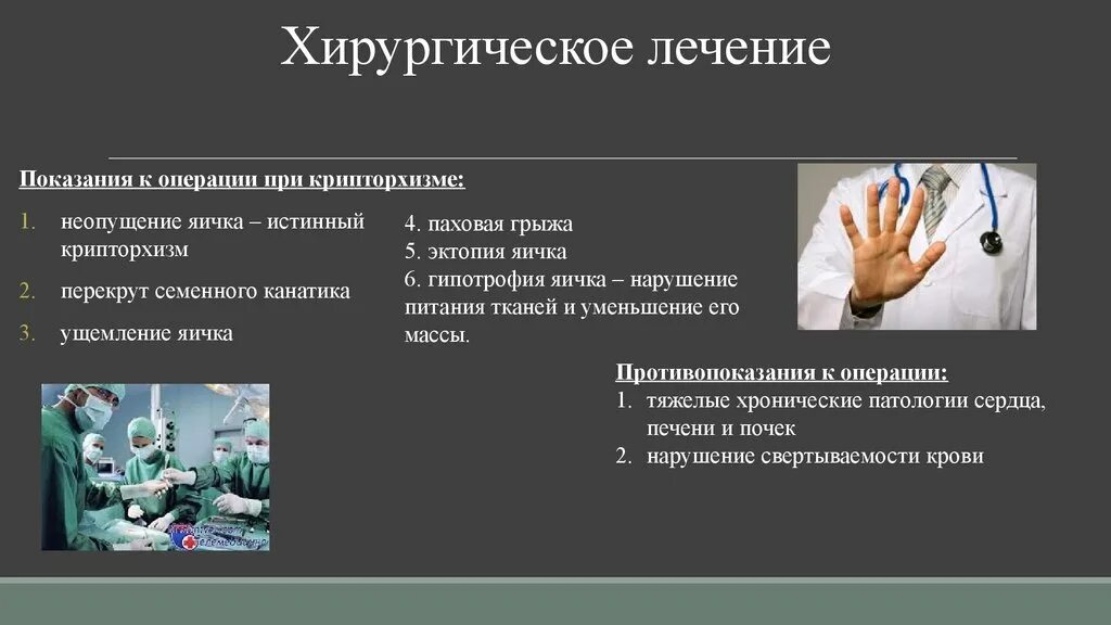 Операции при крипторхизме. Операции при крипторхизме виды. Крипторхизм хирургическое лечение. Крипторхизм презентация.