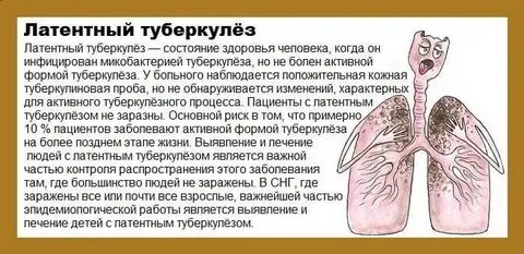 Лечение туберкулеза легких у взрослых на ранней