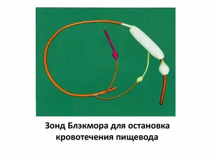 Зонд блэкмора для остановки кровотечения из вен