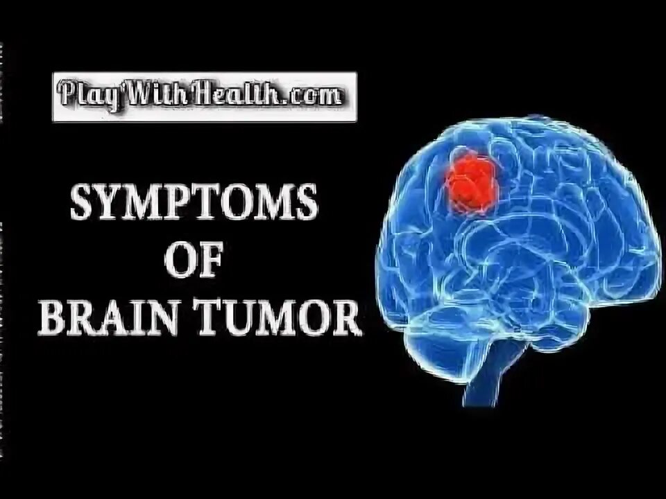 Brain tumor Day. Ротвеллеры Мирой мозг.