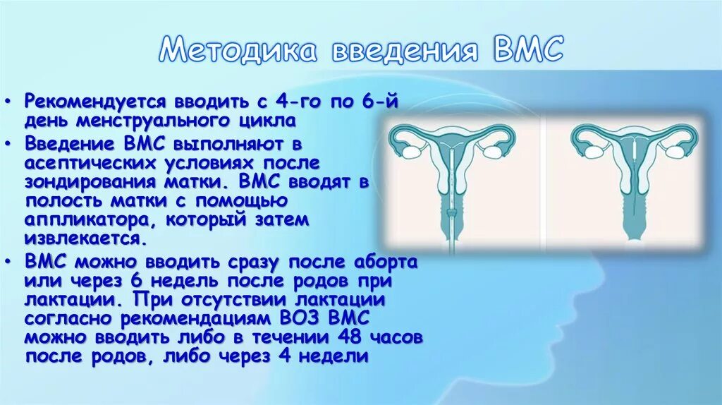 ВМС спираль метод введения. Введение внутриматочной спирали. Введение внутриматочной спирали алгоритм. Введение ВМС алгоритм.