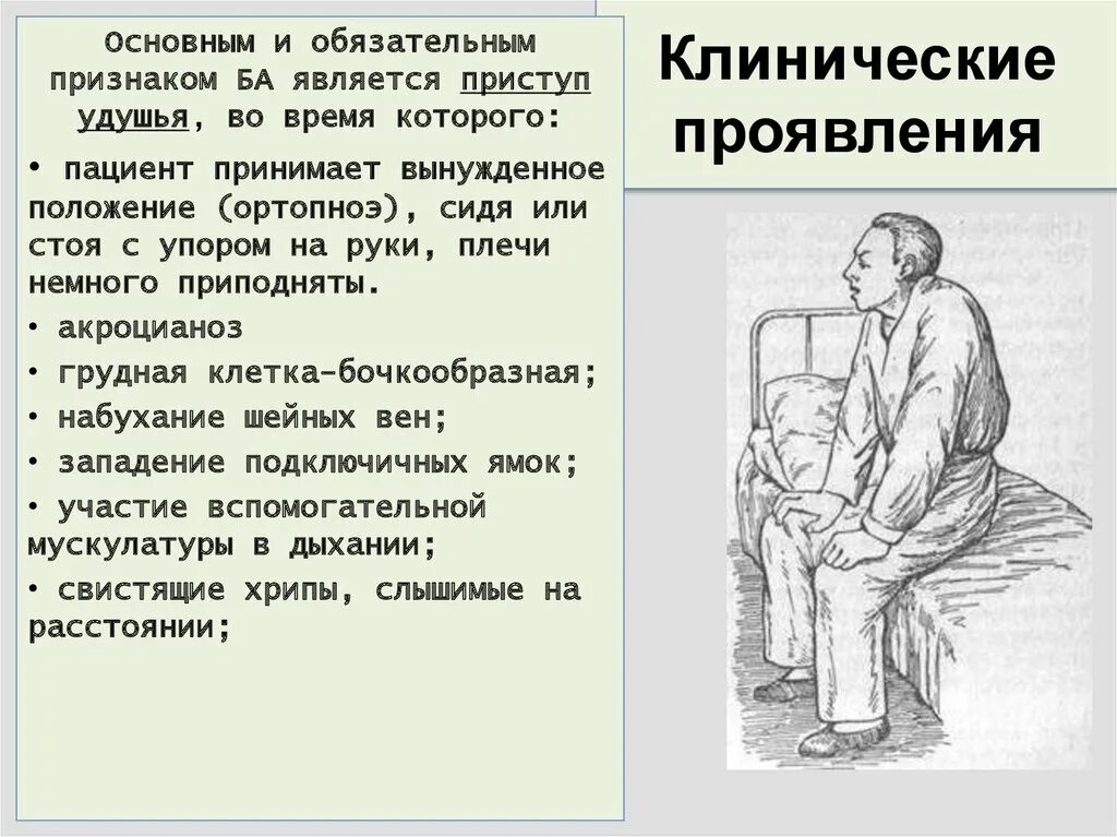 Положение во время приступа бронхиальной астмы. Положение во время приступа бронхиальной астмы
