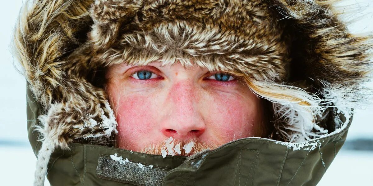 How To Prevent And Treat Windburn, Winter's Overlooked Skin Condition