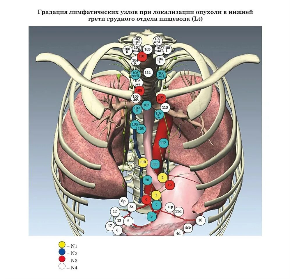 Регионарные лимфатические узлы пищевода. Японская классификация лимфатических узлов пищевода. Лимфоузлы пищевода классификация. Опухоль нижней трети пищевода регионарные лимфатические узлы. Лимфоузлы пищевода