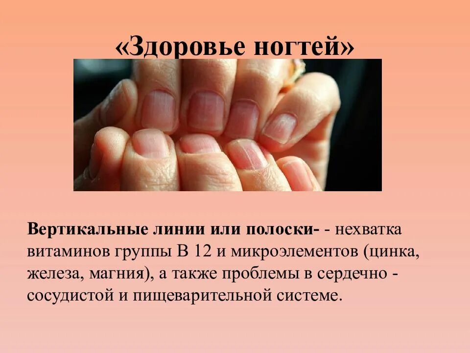ЧТО НОГТИ РАССКАЖУТ О ЗДОРОВЬЕ. - Обсуждение статьи
