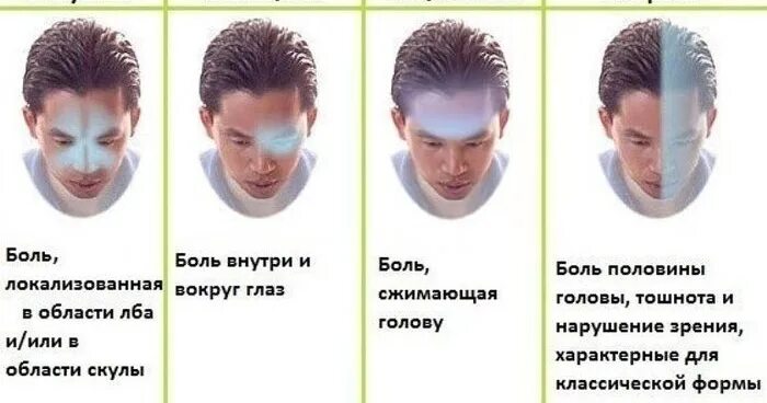 Головные боли напряжения схема Головная боль напряжения: лечим без таблеток Здоровье Селдон Новости