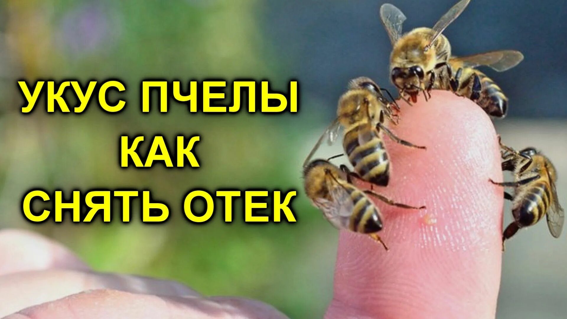 Жалящие насекомые. Оказание помощи при укусе пчелы. Боязнь ос и пчел как называется. Памятка при укусе пчелы. Мечты укусы пчелы для здоровья.