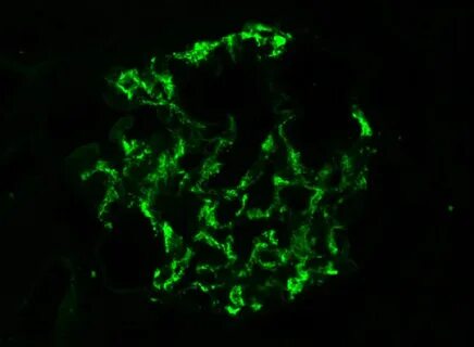 Et al 2011