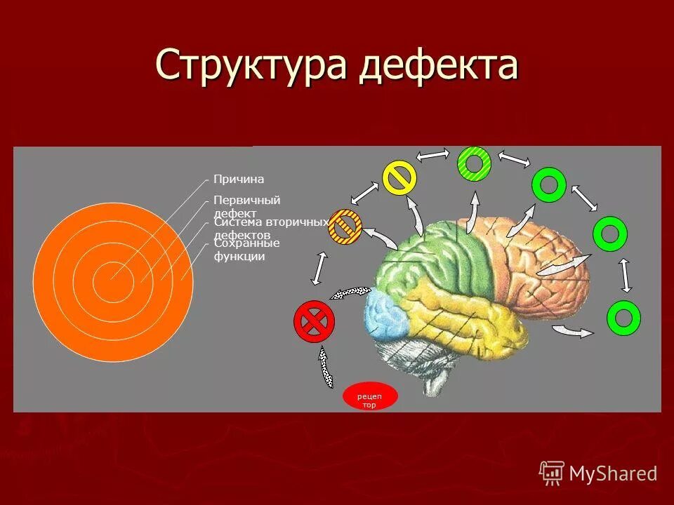 Сложная структура дефекта развития. Сложная структура дефекта выготский понятие. первичный и вторичный дефект. дефект структура дефекта. первичевц и вторичнвй жеыект.