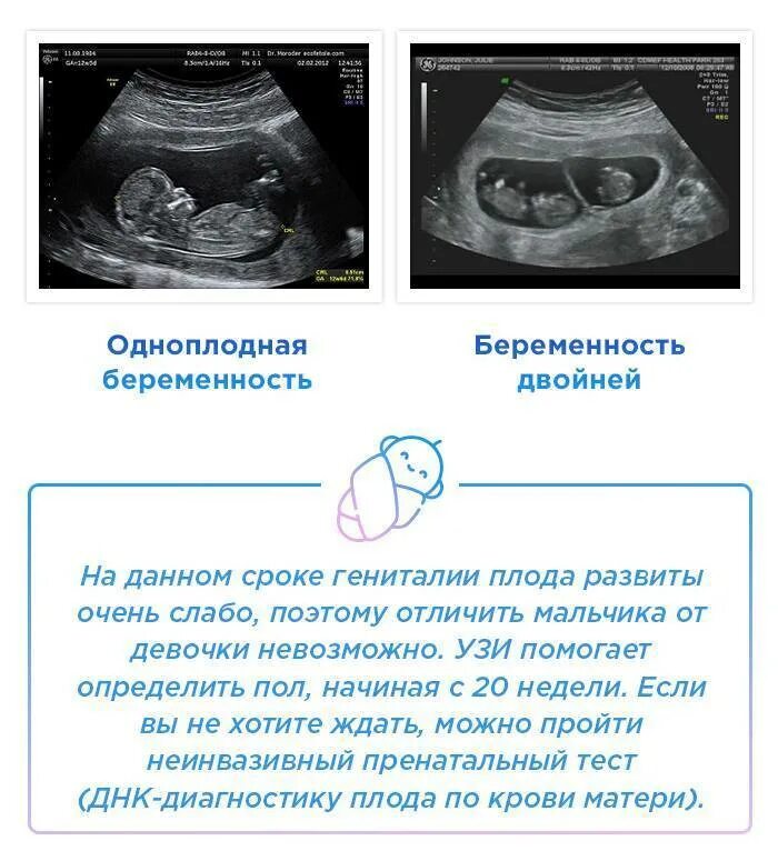 На каком сроке можно увидеть двойню. Узи 12 недель беременности как понять пол. как отличают пол плода на узи 12 недель. узи на определение пола ребенка на каком сроке определяется. на каком сроке можно узнать еол ребенка.