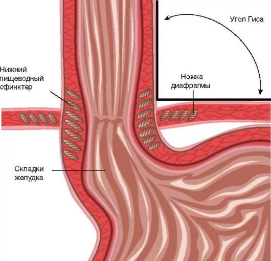 Пищевод складки слизистой. Анатомия Нижнего пищеводного сфинктера. Нижний эзофагеальный сфинктер. Сфинктер Губарева пищевод. Пищеводно желудочный сфинктер.