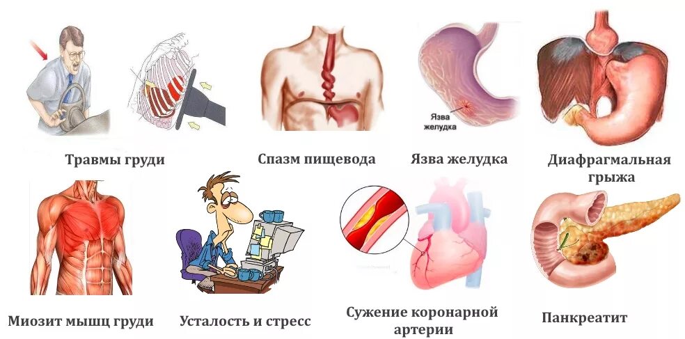 Спазмы мышц грудной клетки. Спазмированная мышца. Спастические сокращения пищевода.