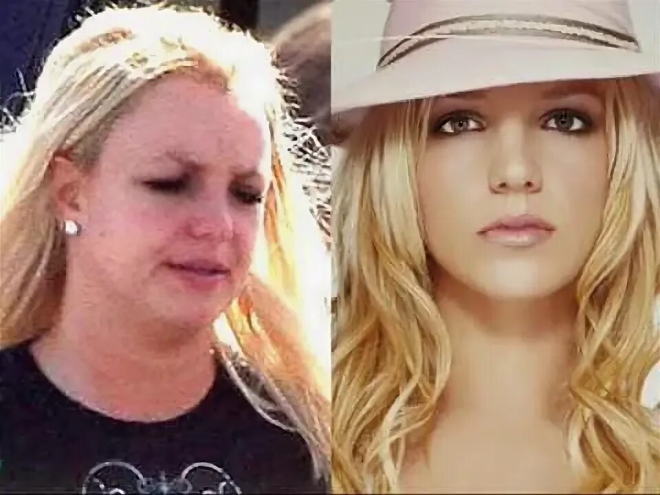 Cesarean Scar Britney Spears