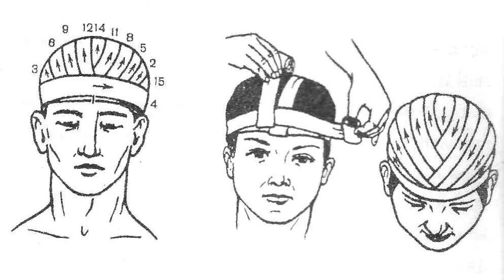 Повязка на голову размеры. Схема наложения повязки шапка Гиппократа. Шапочка Гиппократа. Перевязка головы шапочка Гиппократа. Повязка шапочка Гиппократа десмургия.
