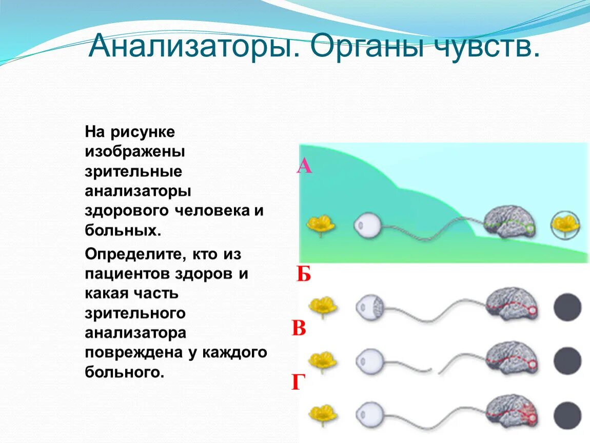 Анализаторы органы чувств 8 класс тест ответы. Анализаторы органы чувств. Какая часть зрительного анализатора повреждена. Зрительный анализатор орган чувств. Анализаторы как органы ощущений.