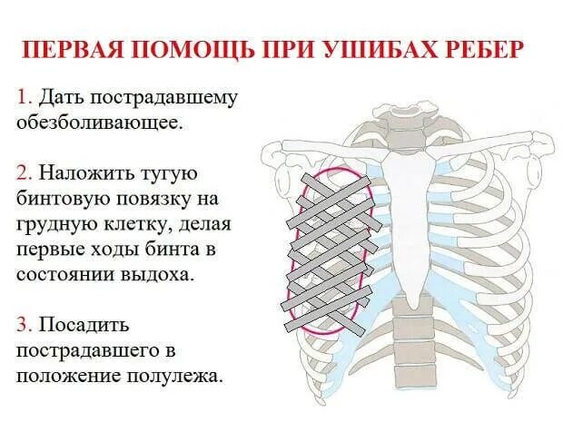 Почему сводит ребра