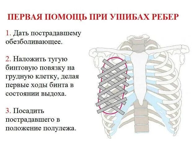 Признаки при переломе ребер. Признаки травмы повреждения рёбер. Перелом рёбер симптомы и первая помощь.