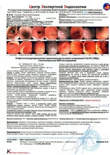 Гастрит отзывы пациентов