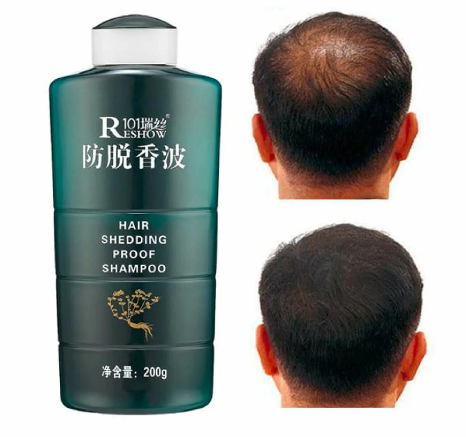 Мужские шампуни от выпадения. Zhangguang 101 hair shedding Proof Shampoo. Шампунь мужской. Шампунь от облысения для мужчин. Шампунь для выпадения волос для мужчин.