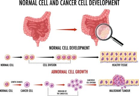 Download Diagram showing normal and cancer cells for free.