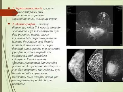 Сүт бездерінің үйдегі порнофотосуреттері