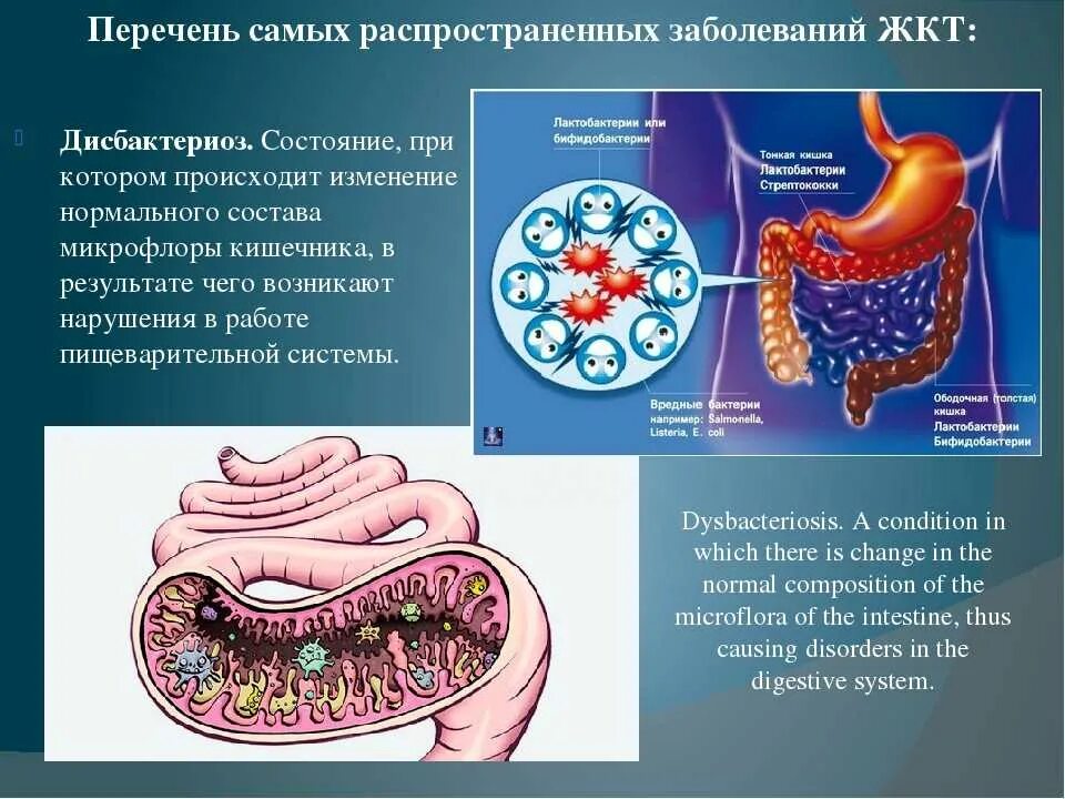 Проблемы с желудком и кишечником. Заболевания пищеварительного тракта. Заболевания органов ЖКТ.