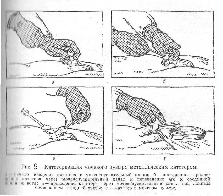 Катетеризация мужчины алгоритм