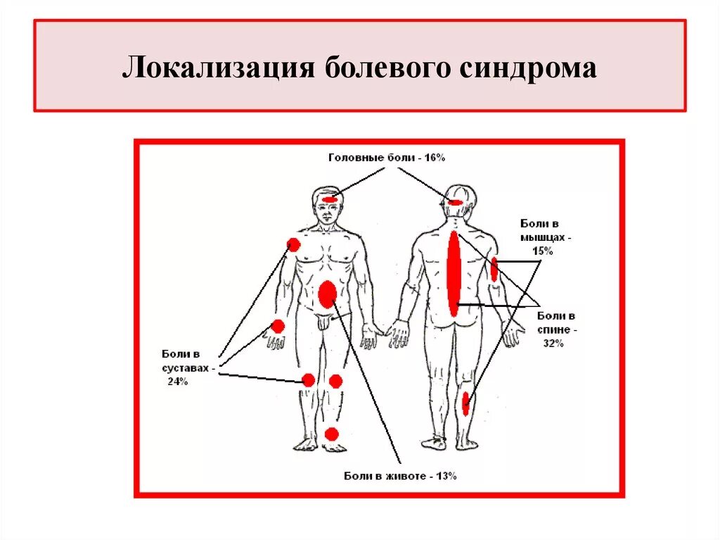 Локализация болевого синдрома. Локализация боли в спине. Локализация боли схема. Локализация это. Заболевания локализация боли