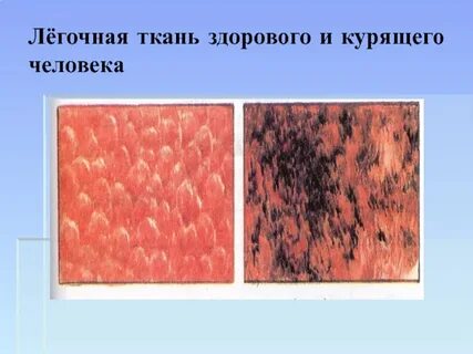 Здоровая ткань