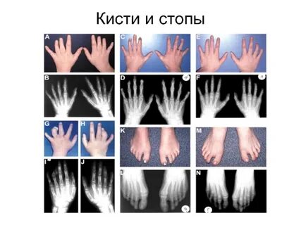 Кисть особенности
