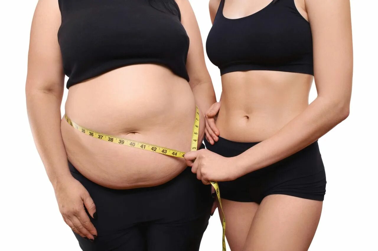 Глютеновое ожирение у женщин. Ожирение похудение. Круглый животик. Женщина с лишним весом.