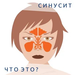 Синусит опасен ли