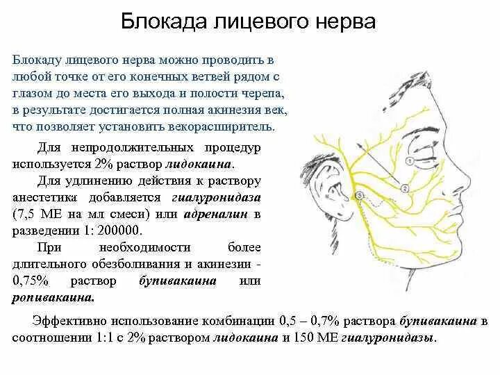 Чем лечить лицевой тройничный нерв. Схема блокады тройничного нерва. Невралгия ушного узла тройничного нерва. Невропатия 2 ветви тройничного нерва слева. Блокада ветвей тройничного нерва топографическая анатомия.