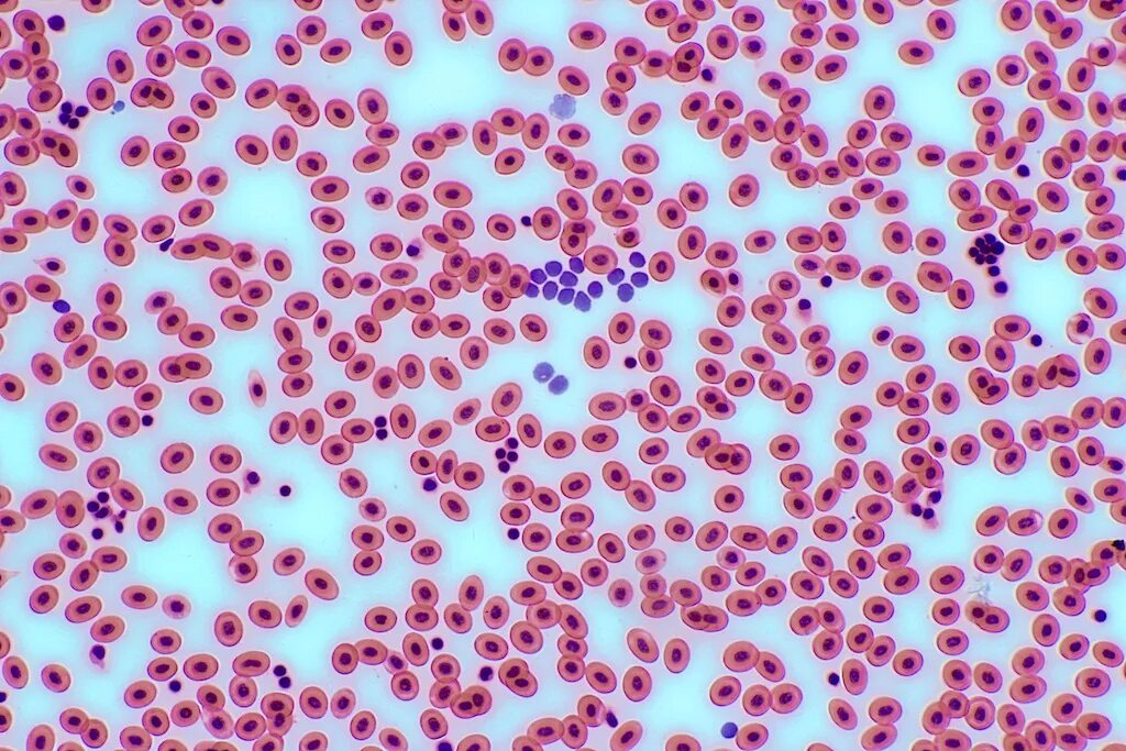 Микро клеток. Лейкоциты крови человека под микроскопом. Кровь лягушки гистология препарат. Эритроциты лягушки под микроскопом. Эритроциты микрофотография.