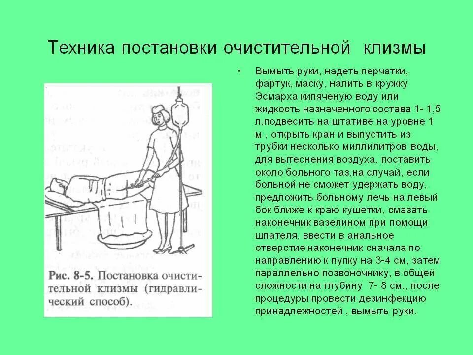 Как поставить человеку клизму