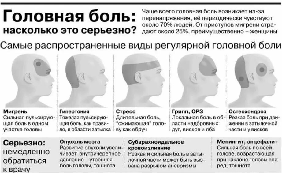 Височная боль с левой стороны. Сильная головная боль сзади головы. классификация головной боли по локализации. причины головной боли. головная боль в висках.