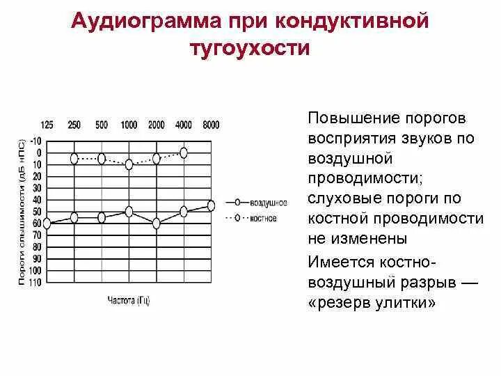 Аудиограмма степени