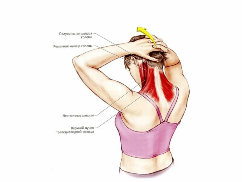 Больно поворачивать голову. Растяжение шейных мышц. Растяжка мышц шеи. Упражнения на растяжение мышц шеи.