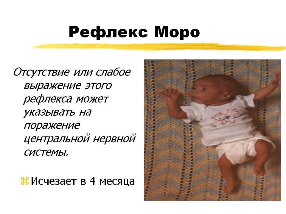 Рефлекс моро у новорожденных рисунок. Спонтанный рефлекс моро. Синдром моро у новорожденных. Рефлекс моро у грудничка в 3 месяца. Синдром моро у новорожденных.