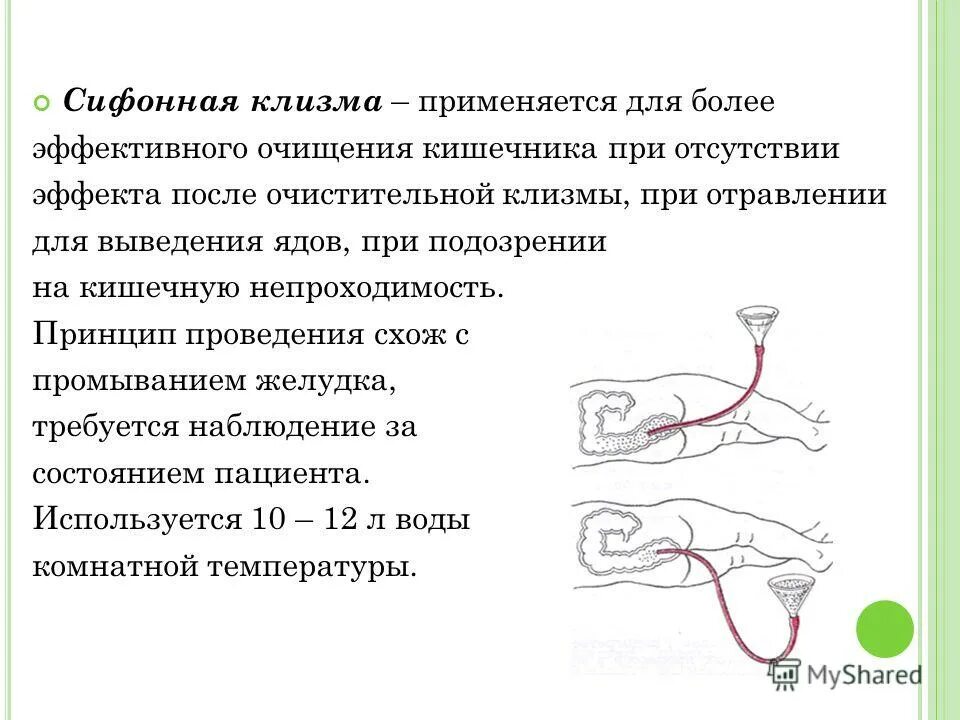 Сифонная клизма кратность. Постановка сифонной клизмы алгоритм. кратность постановки сифонной клизмы. сифонная клизма показания методы проведения. сифонная клизма показания противопоказания.