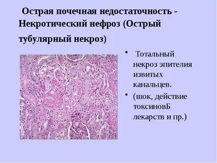 Острая почечная недостаточность препарат