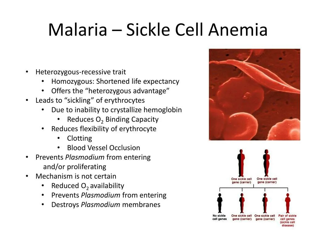 Sickle Cell anemia. Серповидноклеточная анемия и малярия. Серповидноклеточная анемия и малярия связь.