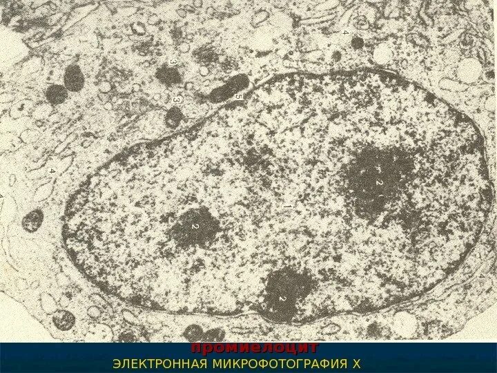 Электронная микрофотография хлоропласта. Лейкопласт электронная микрофотография. Лейкопласт электронная микрофотография. Гепатоциты микрофотография. Лейкопласты микрофотография.