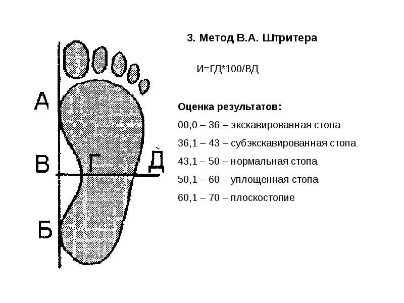 Как определить плоскостопие по отпечатку