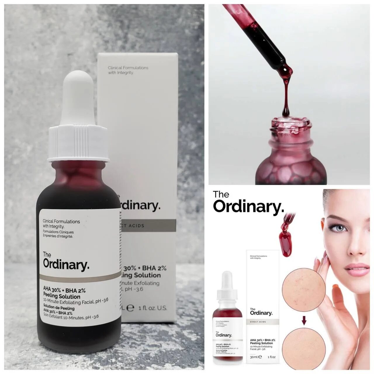 The ordinary peeling solution