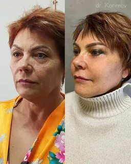 Про смас