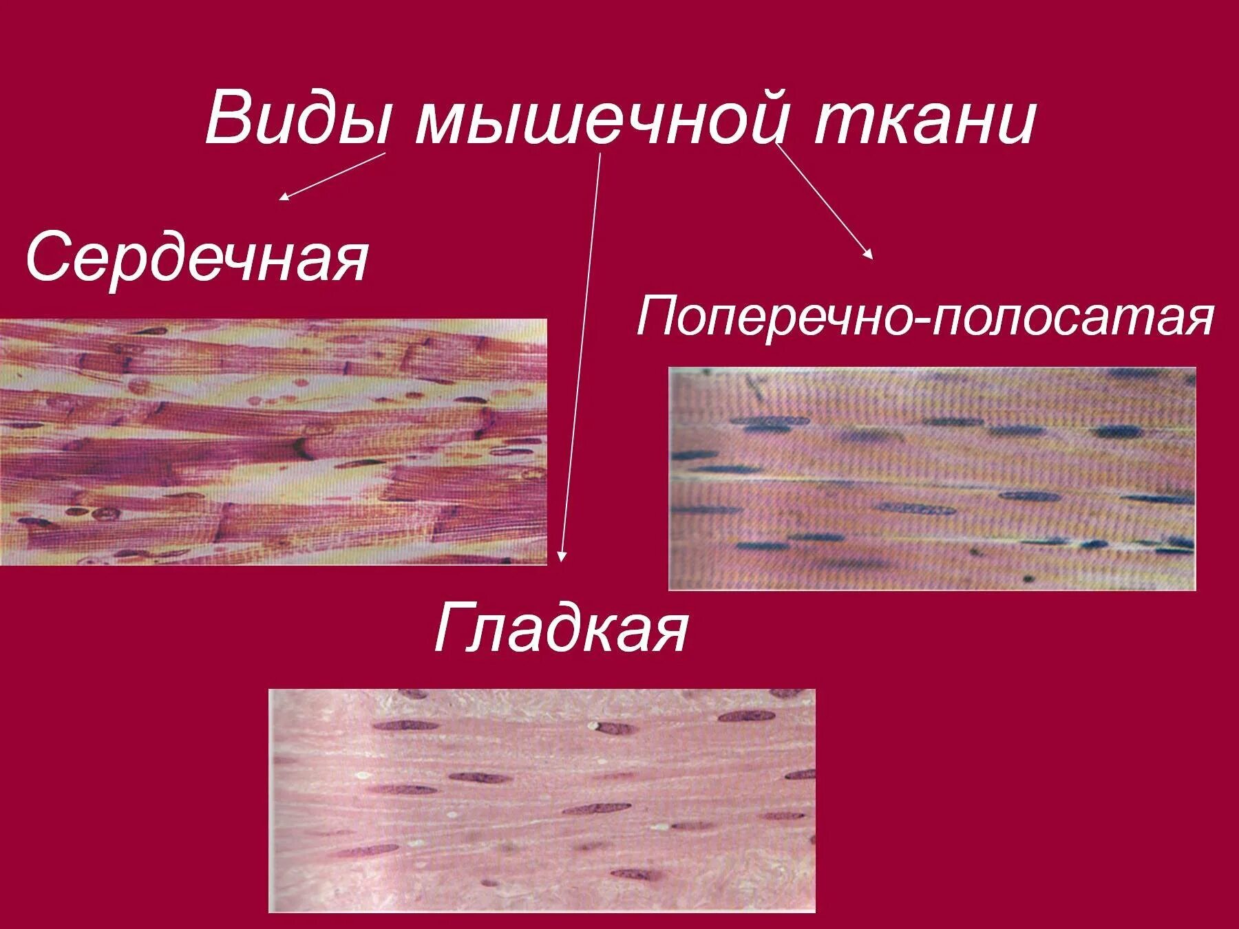 Изображение сердечной поперечно полосатой мышечной ткани. Поперечно-полосатая сердечная мышечная ткань. клетка сердечной поперечно полосатой мышечной ткани. поперечно полосатая сердечная ткань строение. сердечной поперечнополосатой мышечной ткани.