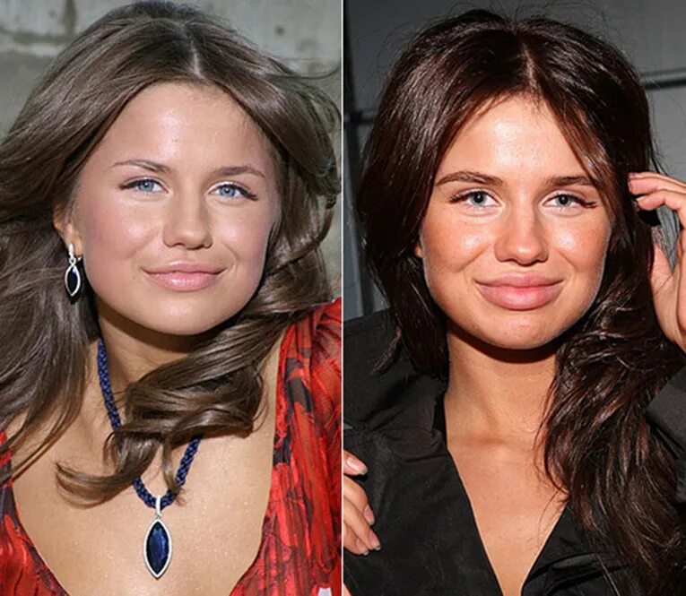 Саундтрек до и после. Лицо до после. Контурная пластика носа. Саундтрек до и после. Наращивание ресниц до и после.