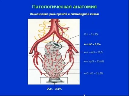 Рак прямой кишки и мочевого пузыря