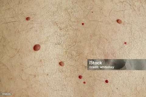 Жыныстық қатынаста бүйірлік позиция